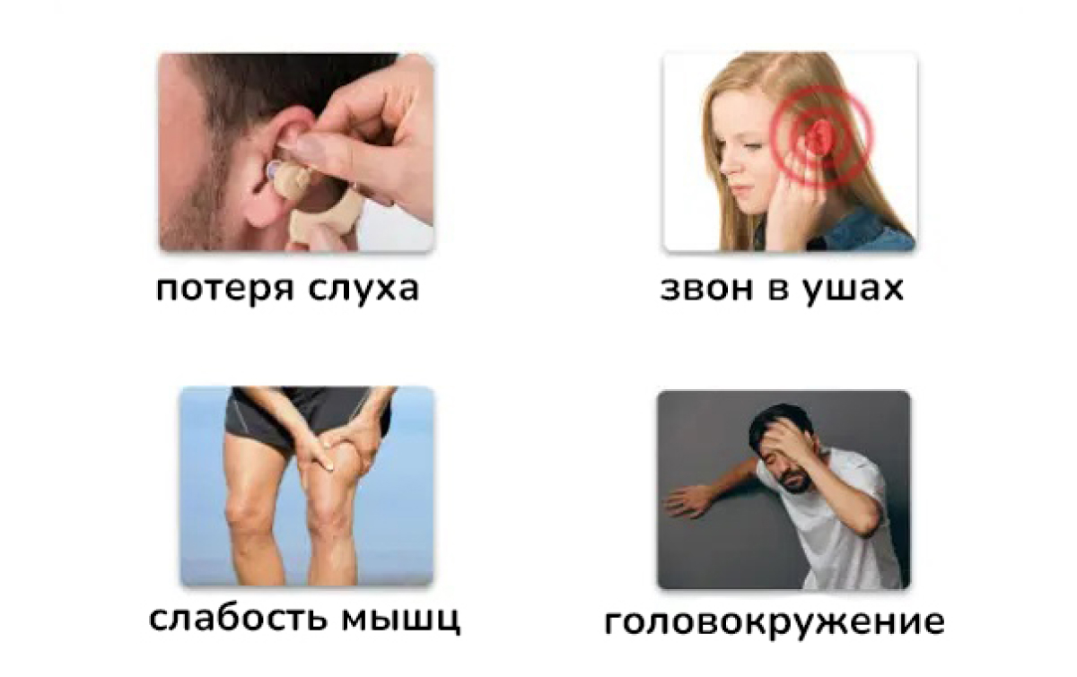 Симптомы невриномы слухового нерва