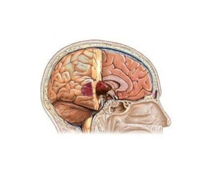 изображение структур головного мозга