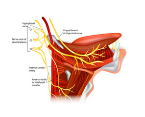 схематическое изображение невралгии языкоглоточного нерва