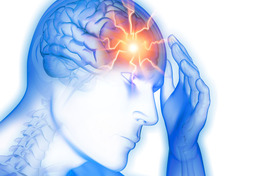 схематическое изображение локализации головной боли